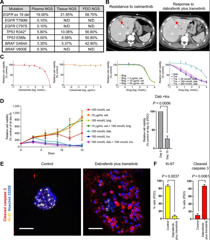 1663586513148016.png image.png